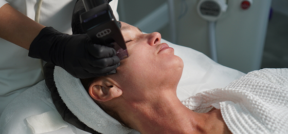 Как работает микроигольчатый RF-лифтинг Morpheus 8